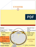 Uveitis