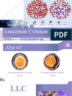 Leucemia Crónica Expo