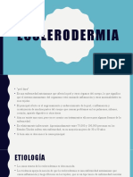 Esclerodermia