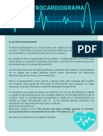 Electrocardiograma: Parresia