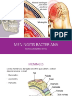 Meningitis Bacteriana: Causas, Diagnóstico y Tratamiento