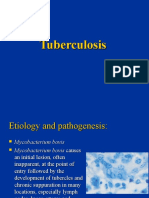 Tuberculosis