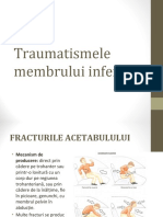 Fractura femur proximal