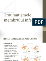 Fractura Femur Proximal