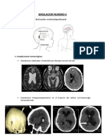 Casos Clínicos de Hidrocefalia