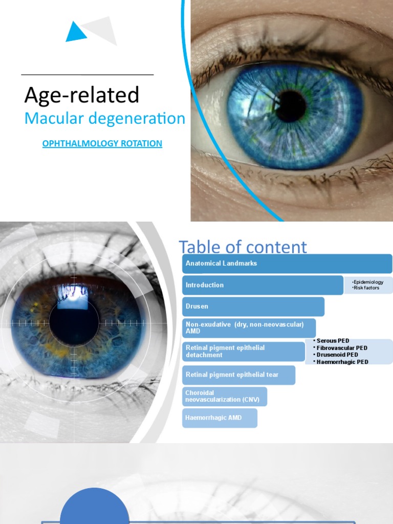 Age-related Macular Degeneration Overview | PDF | Retina | Ophthalmology