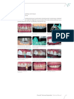 Injection moulding technique.pdf