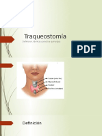 Traqueostomia Tecnica