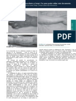 ULTIMA 1 TRADUCCION PAG 5-12 - Grabb-and-Smith-s-Plastic-Surgery-7th-Edition (PDF - Io) ES (PDF - Io)