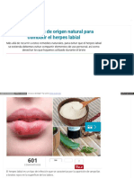 7 Tratamientos de Origen Natural para Combatir El Herpes Labial