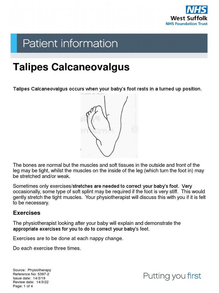 Talipes Calcaneovalgus PDF Foot Finger