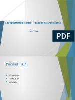 Spondilartritele Axiale - Spondilita Ankilozanta: Caz Clinic