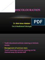 Teeth Discolouration: Dr. Afrah Adnan Aldeliaimi