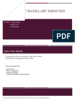 Principle of Maxillary Impacted Teeth: Done By: Yamamh Emad Hadeel Luay Yaseen Tareq