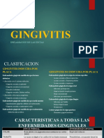 GINGIVITIS