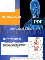 TIROTOXICOSIS