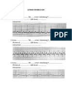 Tugas Intrepertasi EKG-dikonversi