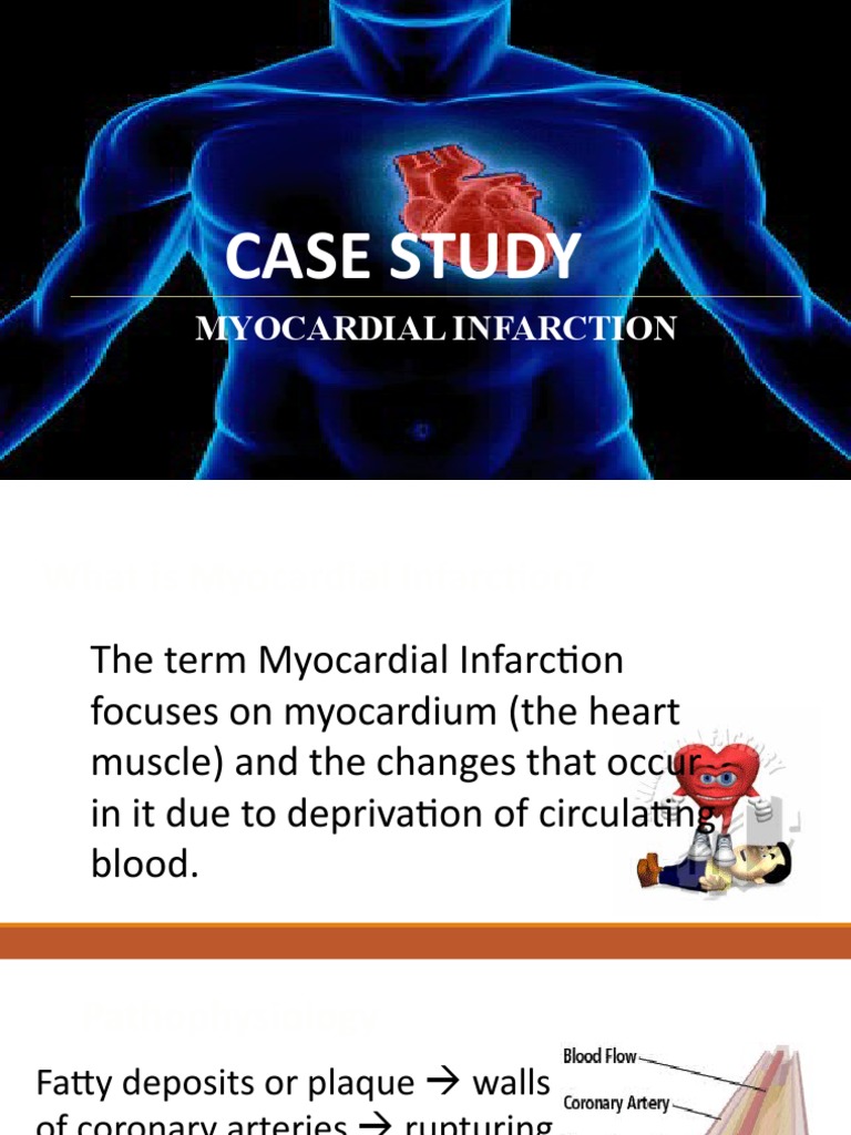 Case Study: Myocardial Infarction | PDF