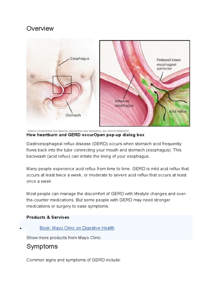 How Heartburn and Gerd Occuropen PopUp Dialog Box Book Mayo Clinic
