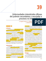 Sarcoidosis, HX, LLM, Microlitiasis, NEUMOSUR PDF