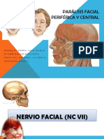 Parlisis Facial