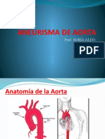 Aneurisma de Aorta