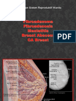 Fibroadenoma Mastitis Abscess Karsinoma Breast