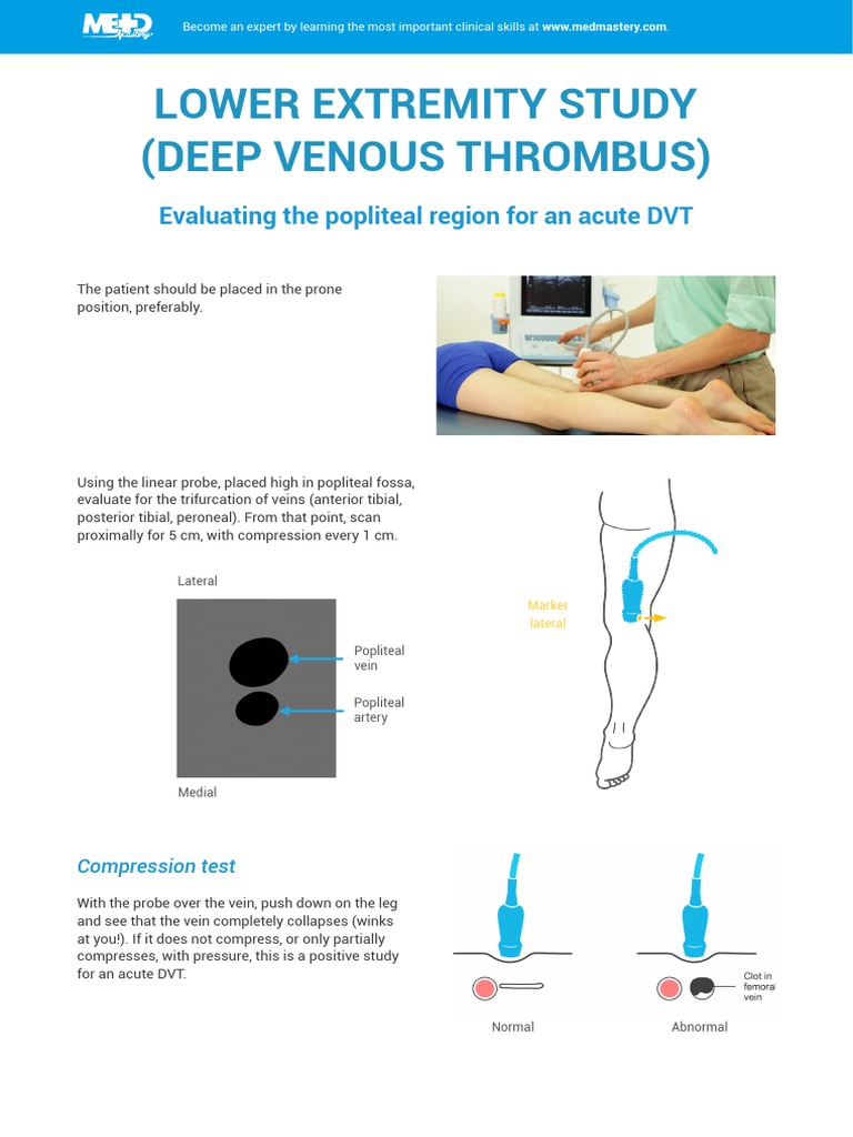 Popliteal Compression Test for DVT | PDF