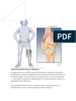 Osteosarcoma: Cáncer de huesos en jóvenes