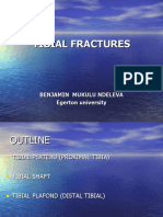 16th TIBIAL Fractures