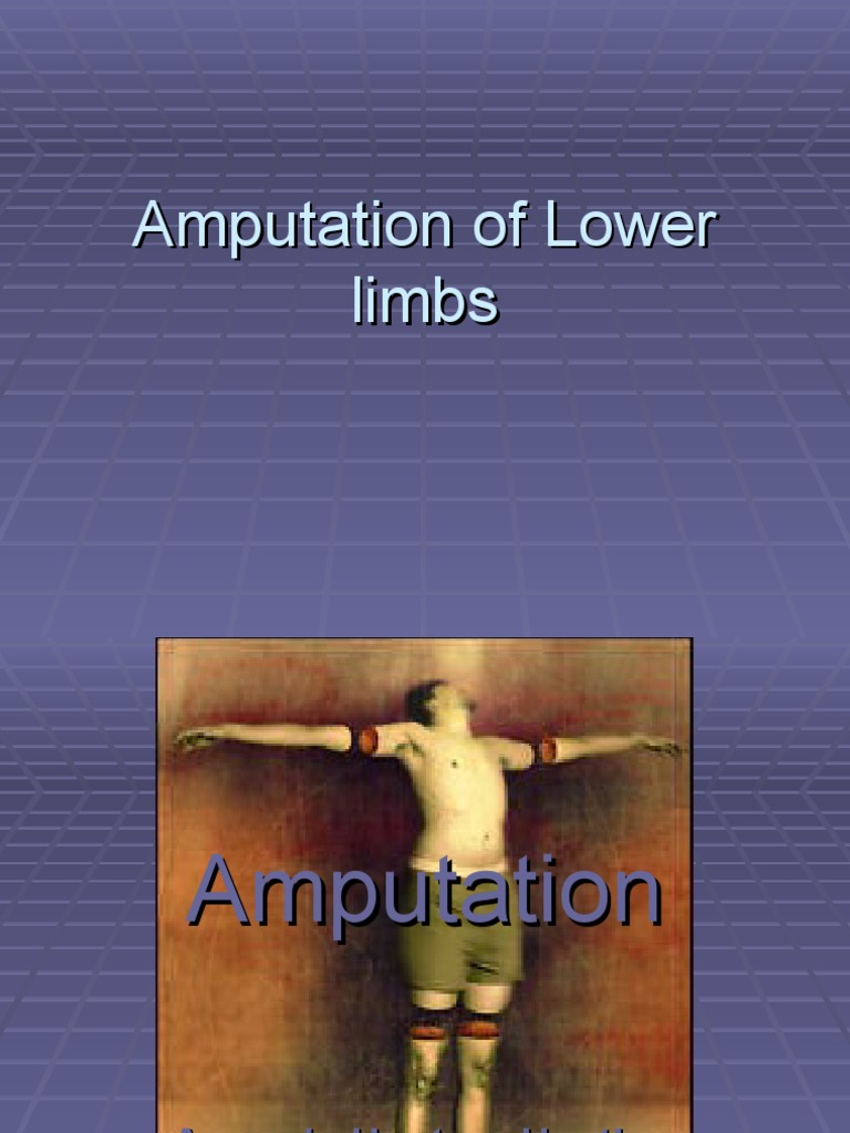Lower Limb Amputation Overview | PDF | Amputation | Prosthesis