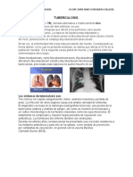 TUBERCULOSIS PULMONAR Y EXTRA PULMONAR.pdf