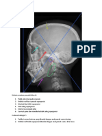 Kriteria cranium proyeksi lateral