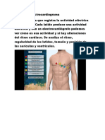 Que es un electrocardiograma (ECG