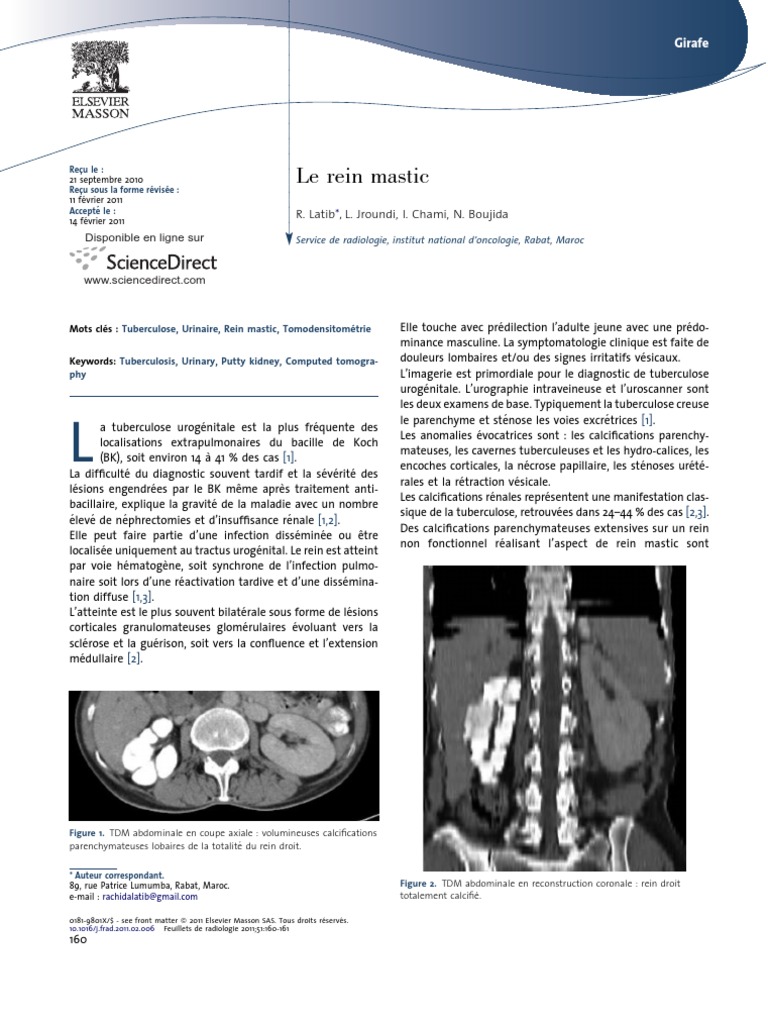 Tuberculose urinaire et rein mastic | PDF | Tuberculose | Sciences de ...