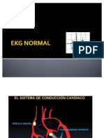 ekg rotación