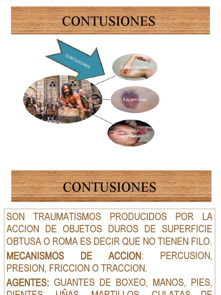 CONTUSIONES | PDF | Derecho