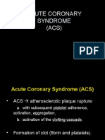 Acute Coronary Syndrome (ACS) Pathophysiology and Treatment