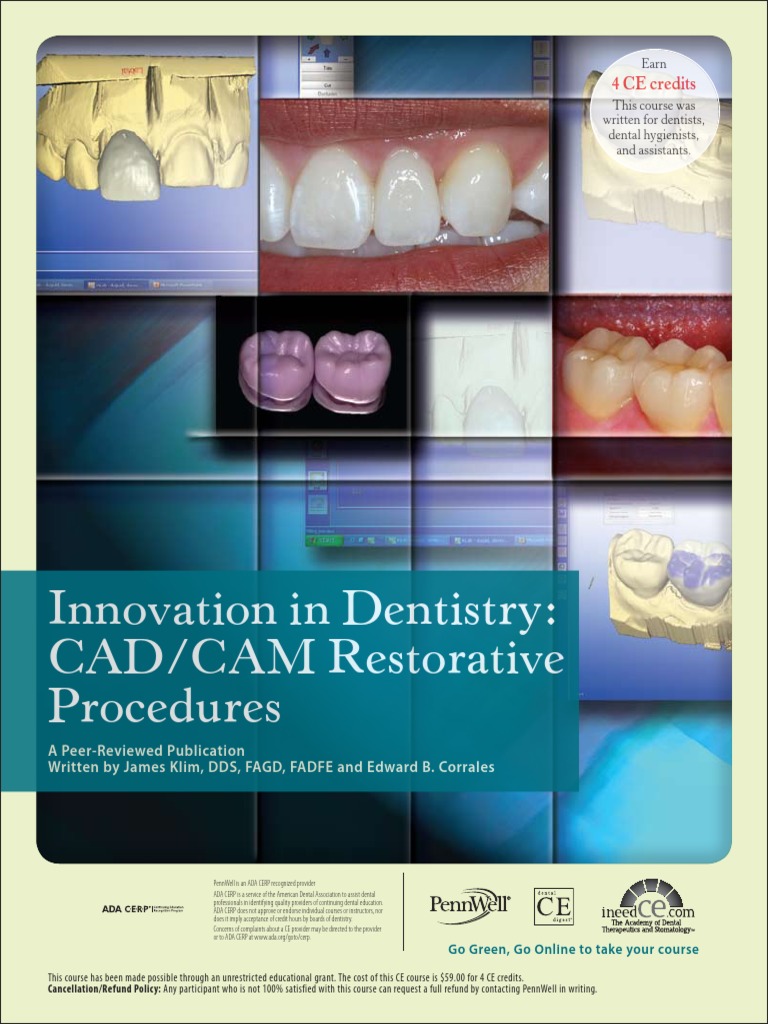 Innovation in Dentistry - CADCAM Restorative Procedures PDF | PDF ...