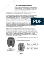 Tarea Opta