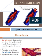 Thrombosis and Embolism Explained