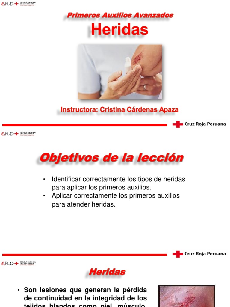 Tipos y Manejo de Heridas en Primeros Auxilios | PDF | Herida ...