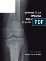 19 Tumores Oseos Malignos Drtorner PDF