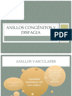 Anillos Congenitos