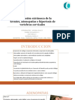 Comprensión Extrínseca de La Tiroides, Adenopatías e Hiperestosis