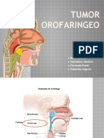 TUMOR OROFARINGEO Ya