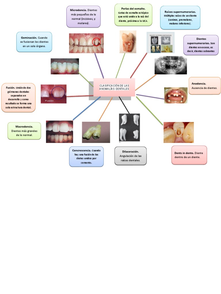 Mapa Mental Anomalias Dentales | PDF | Diente | Cabeza y cuello humanos