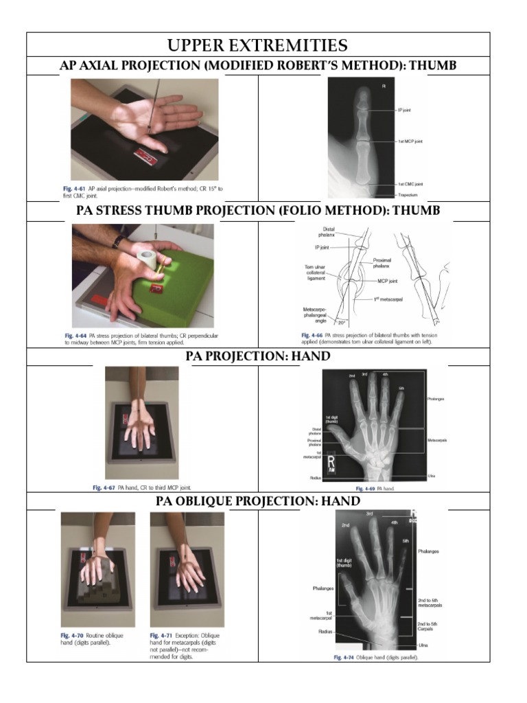 Upper Extremity X-Ray Projections Guide | PDF | Elbow | Anatomical ...