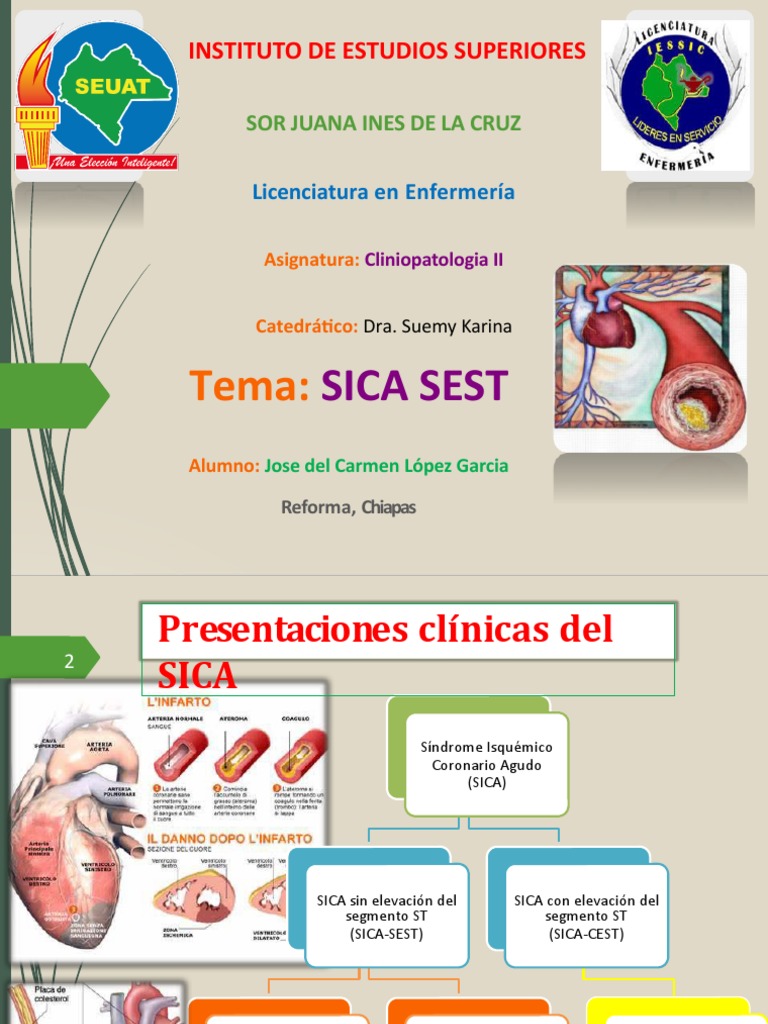 Manejo del SICA SEST en Infarto Agudo | PDF | Infarto de miocardio ...