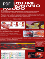 Guía SICA: Diagnóstico y Tratamiento | PDF | Infarto de miocardio ...